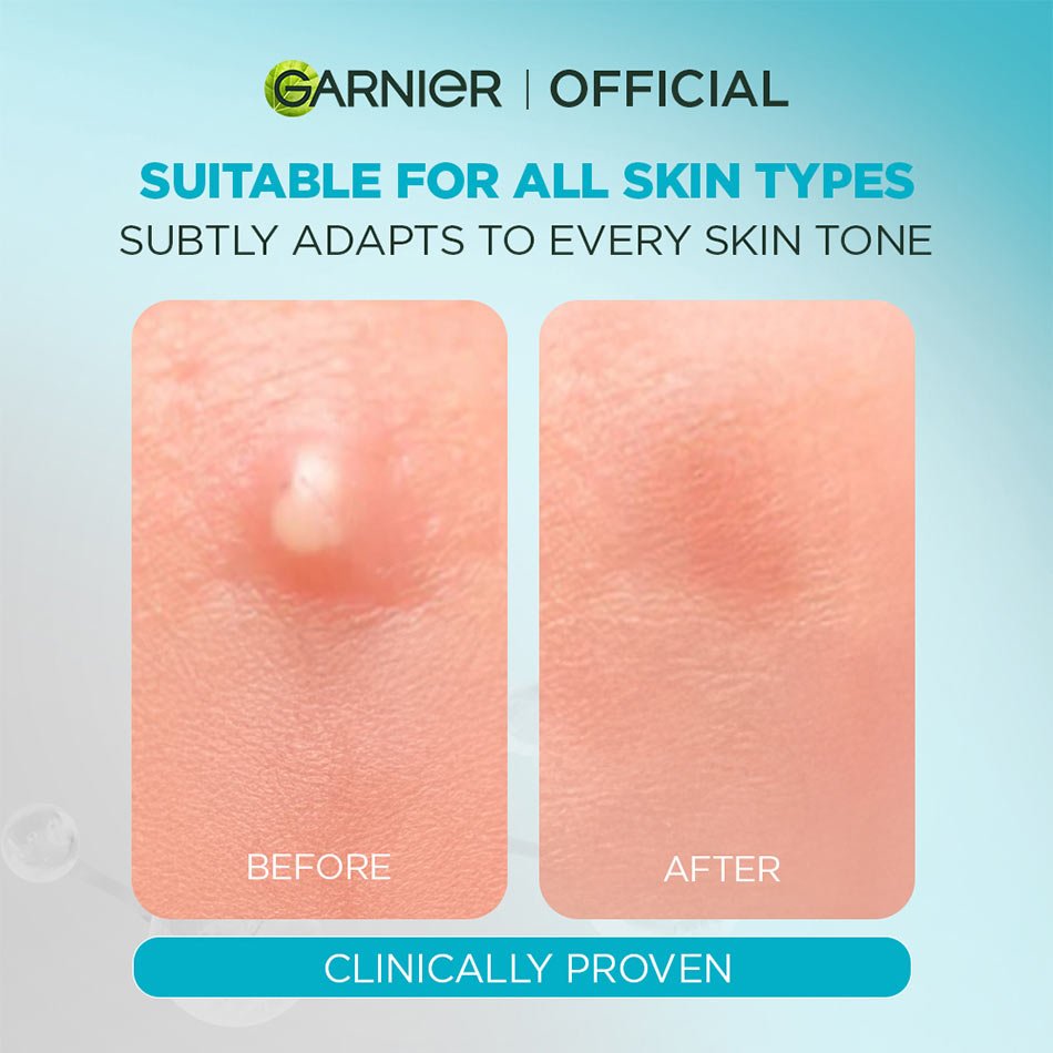 Garnier Pimple Patch 8